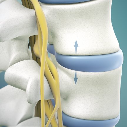 spinal-decompression-drx9000-320